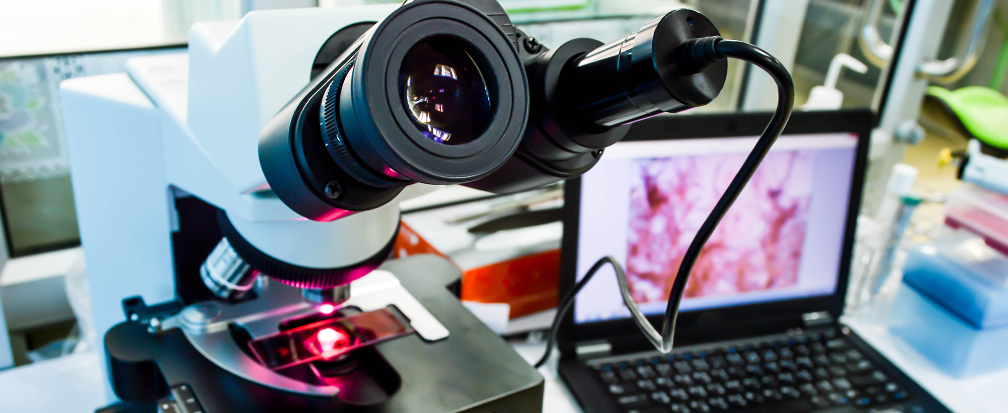 Microscope And Display